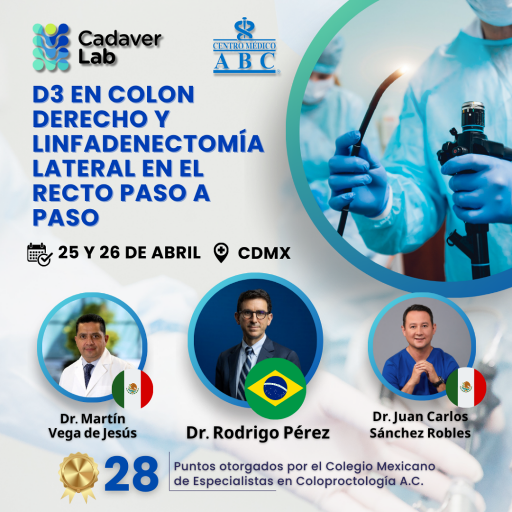 D3 EN COLON DERECHO Y LINFADENECTOMÍAcorec