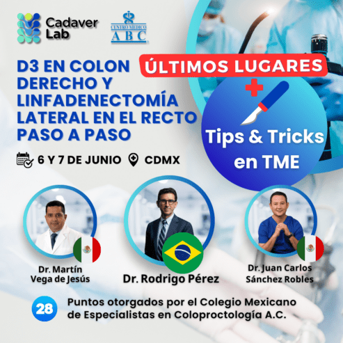 Streaming D3 en Colon Derecho y Linfadenectomía Lateral en el Recto Paso a Paso. Tips & Tricks en TME (Total Mesorectal Excision).